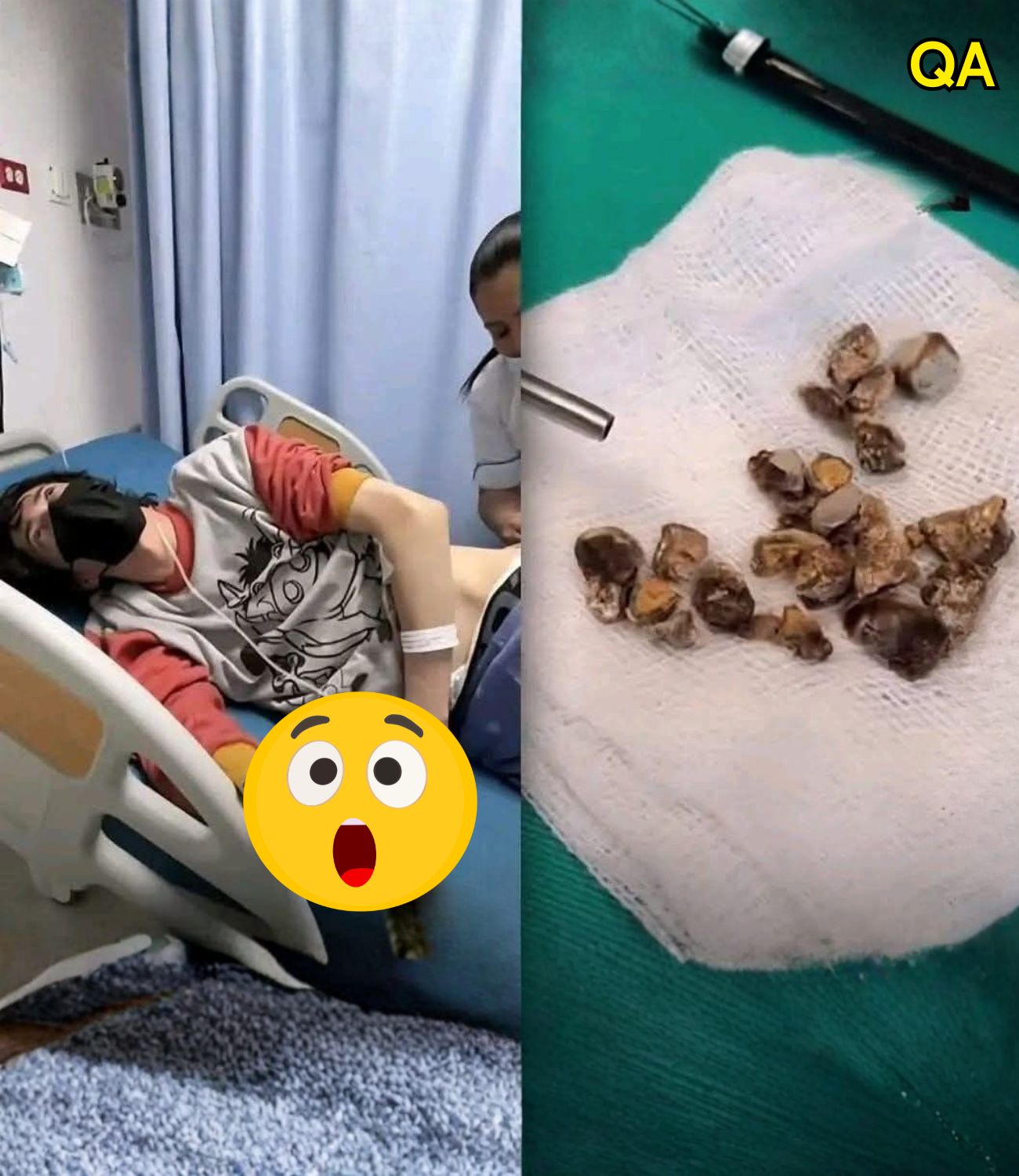 HT1. Man hospitalized after allowing himself to be pe… See more
