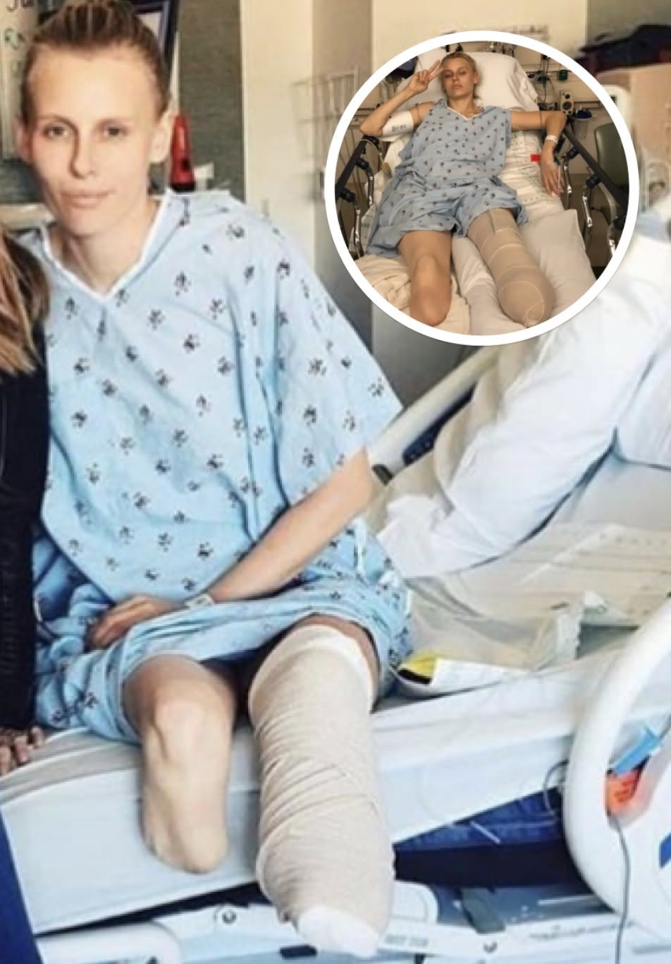 HT6. Woman Loses Her Legs Due To Common Household Product, Now She’s Warning Women Everywhere
