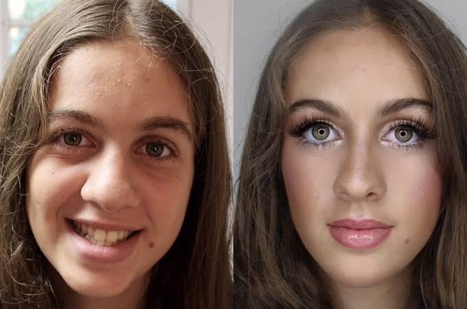 ST1. 40+ Incredible Transformations That Show the Power of Modern Beauty and Skin Care