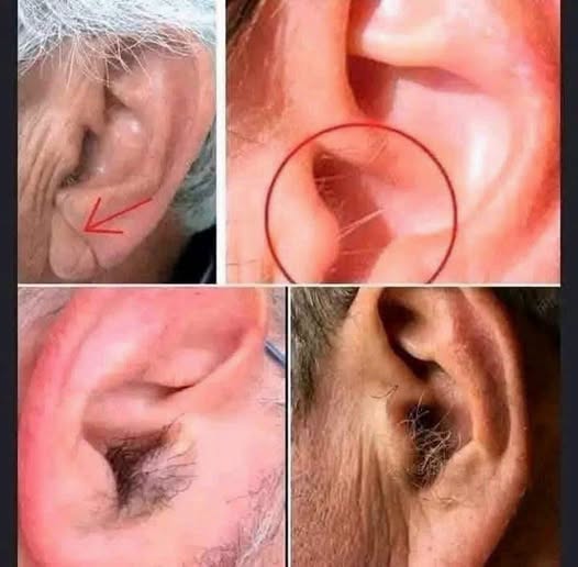 HT7. Did You Know That If Hair Grows On Your Ears It Is Not A Sign Of