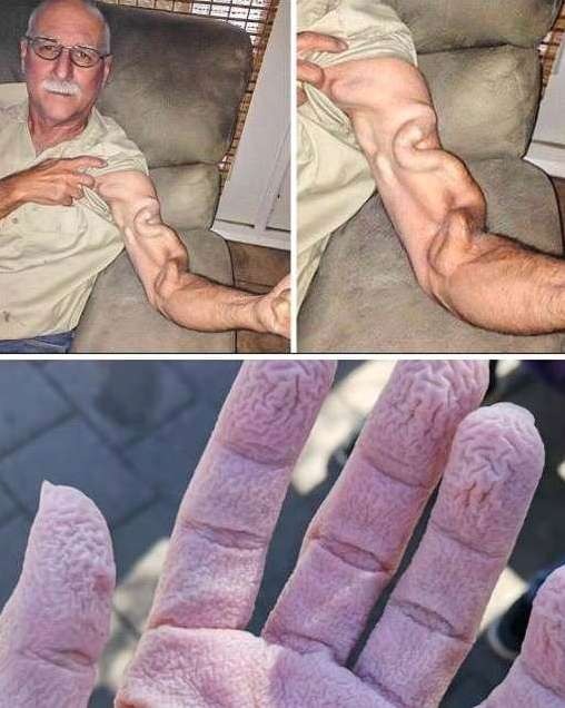 HT14. A man goes to stretch and ends up feeling a sharp pain in his arm, it was a ca… See more