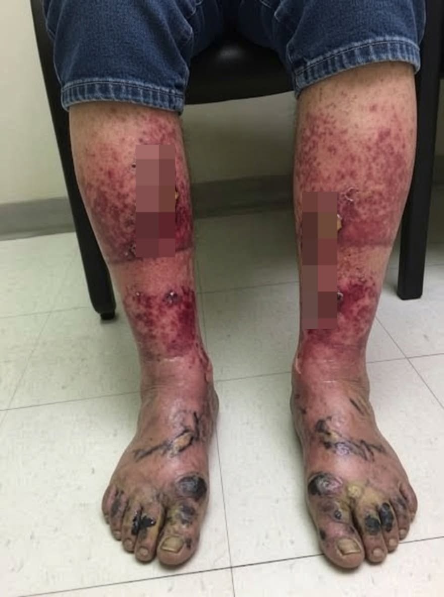 HT6. These are the consequences of sleeping with…See more.