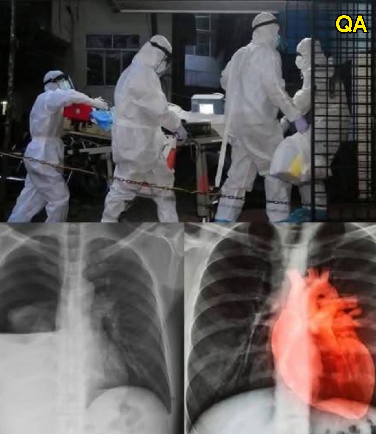 HT14. Alert COVID vaccinated may be enf… See more