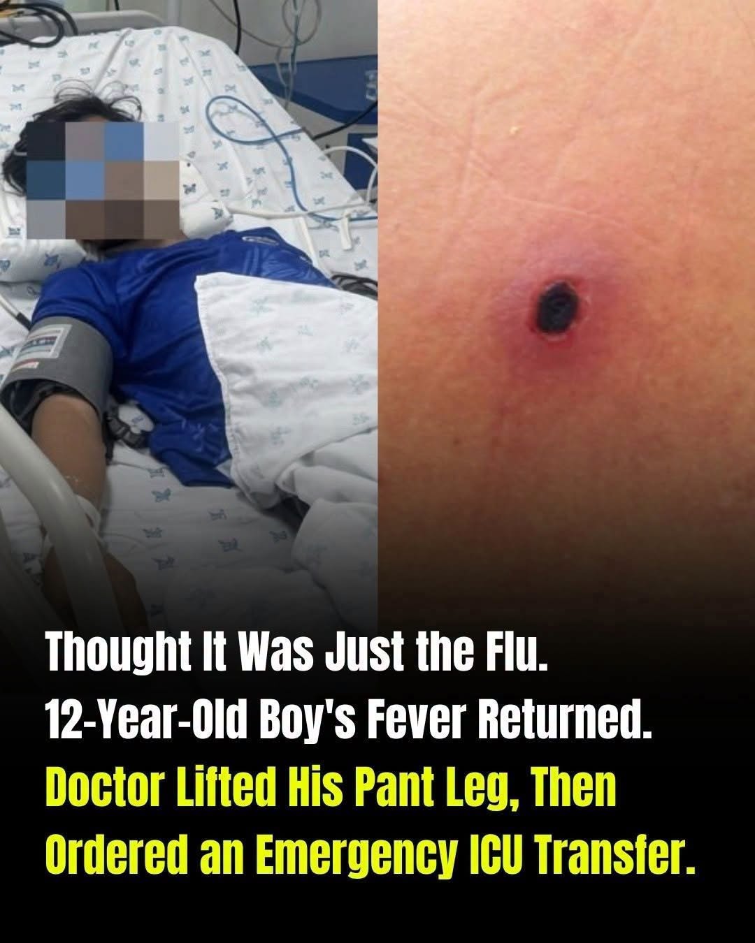 HT6. The Deadly Fever: Why You Must Check Your Child for This One Subtle Mark Immediately