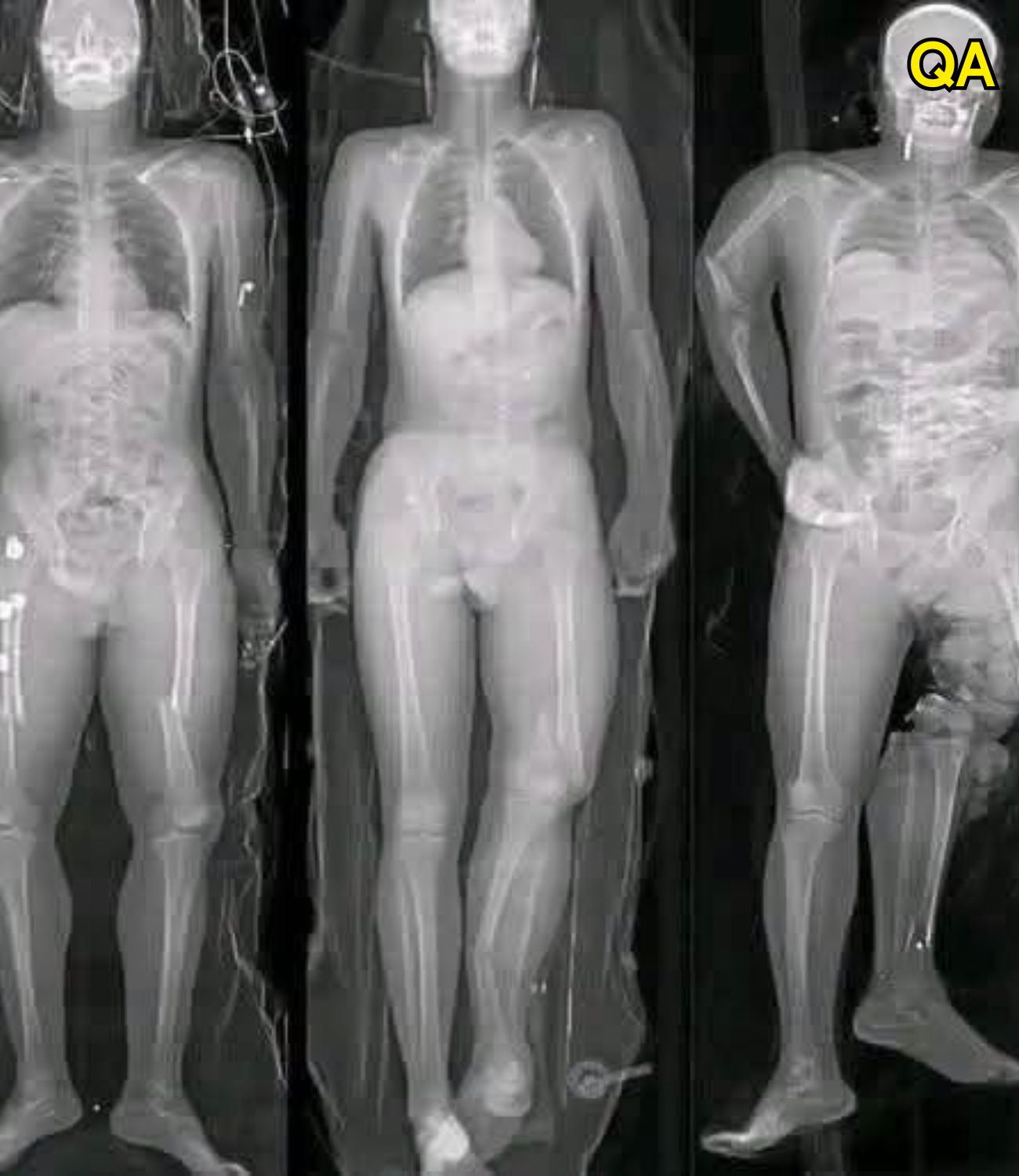 HT14. What you should know if you got the COVID vaccine