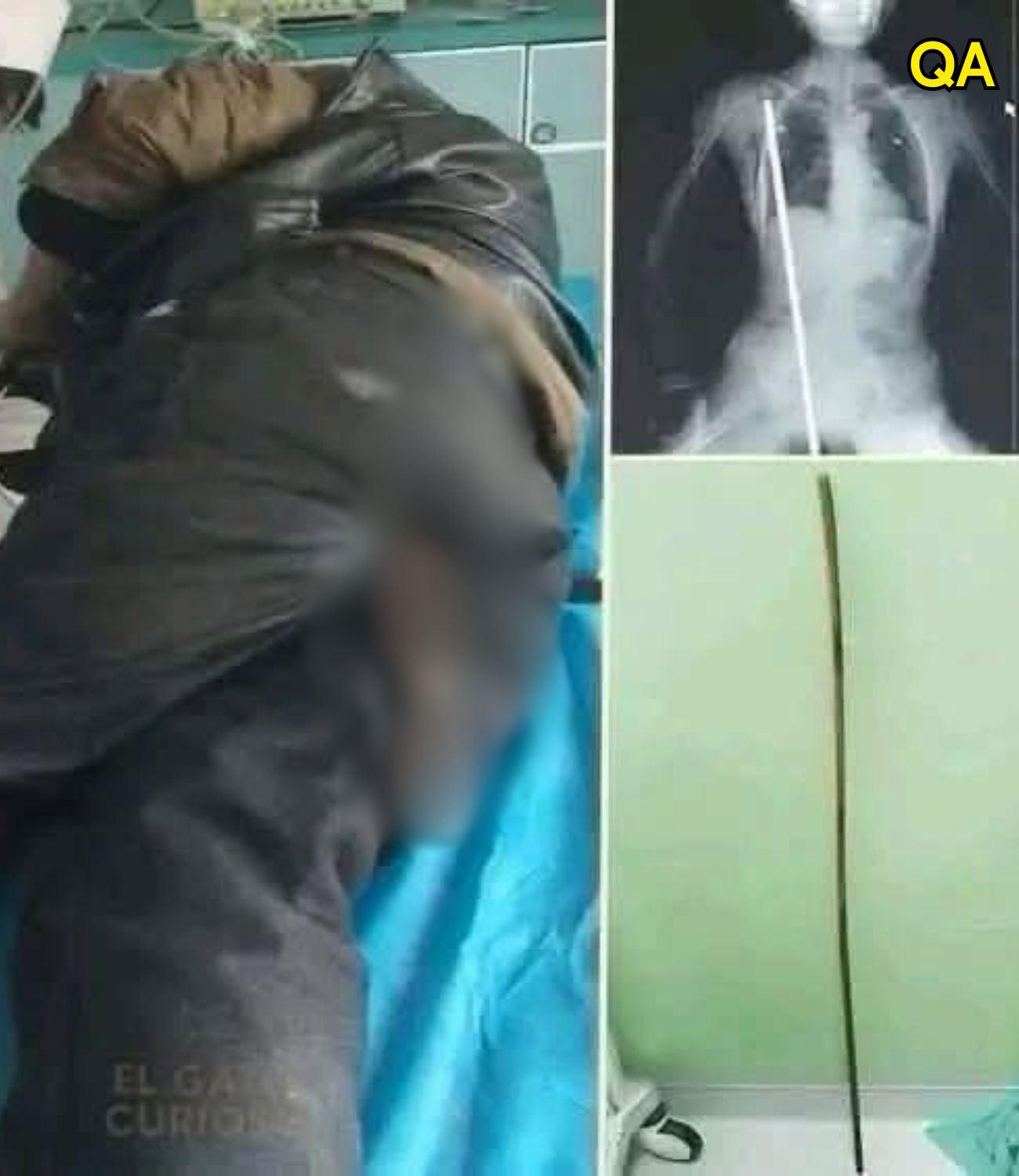 HT6. Young man hospitalized after being arrested….