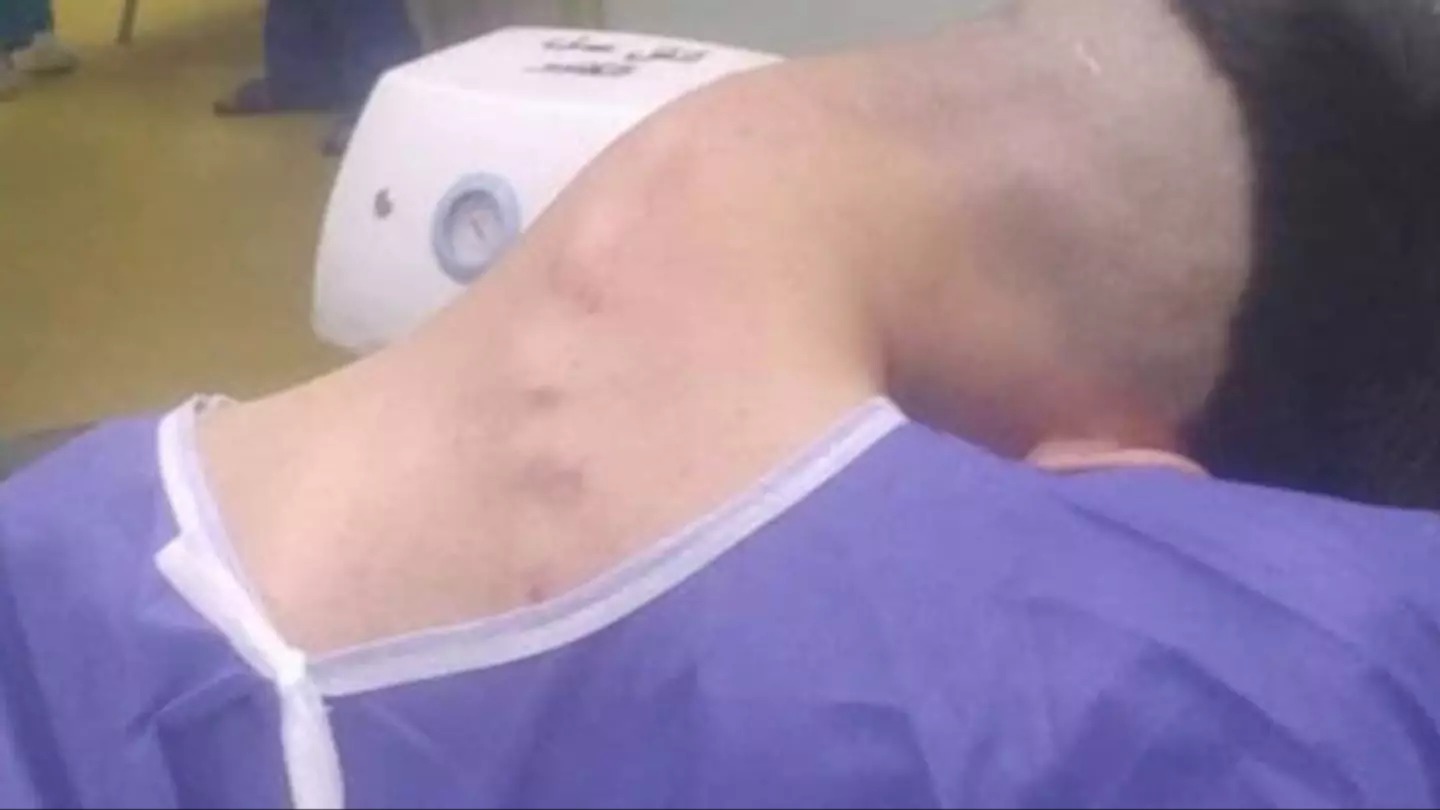HT1. Young man hospitalized because he dropped his