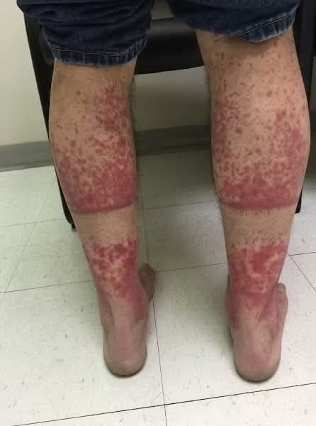 HT14. These are the consequences of sleeping with…See more