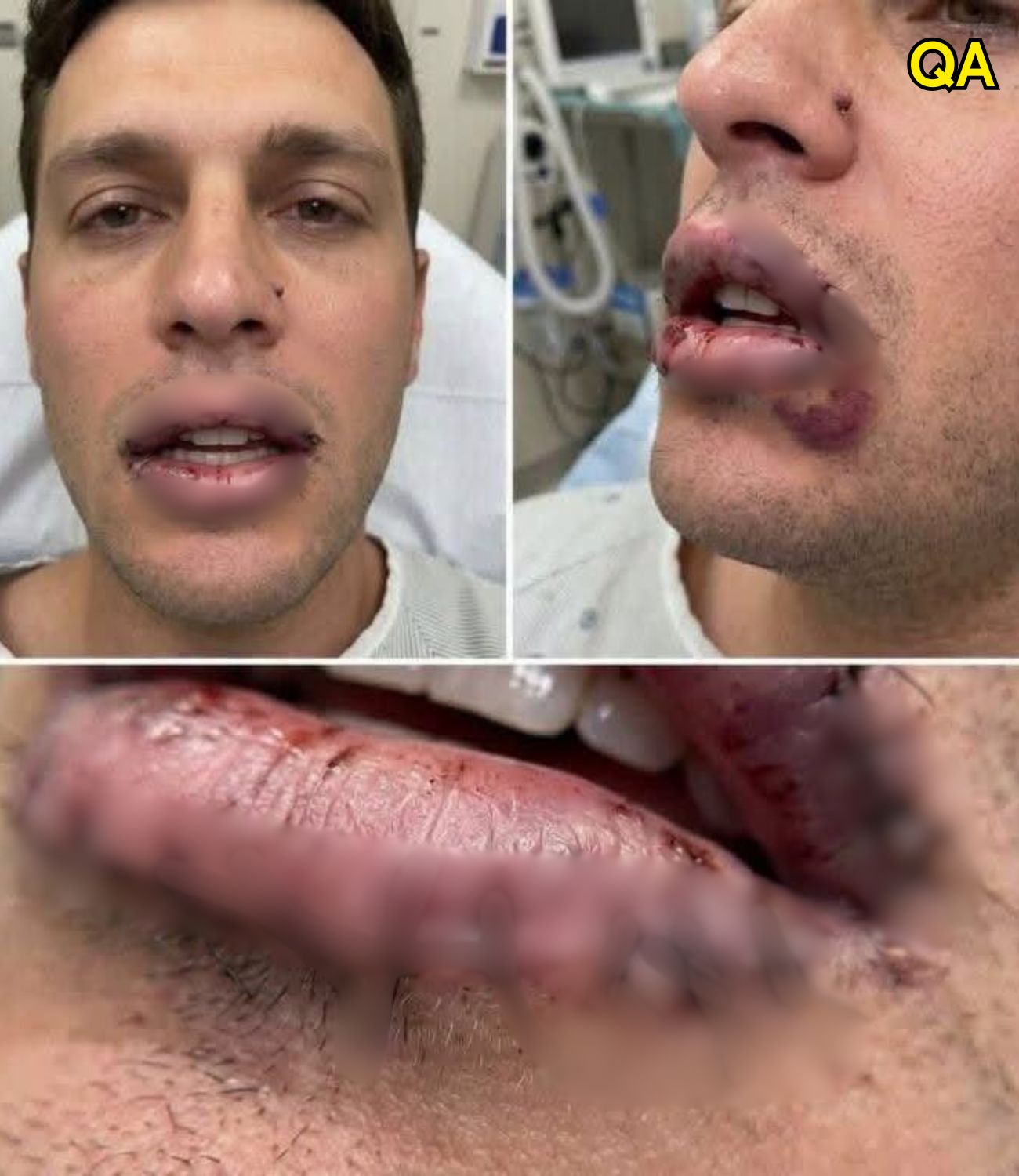 HT14. What happened next caused a man to seek urgent medical attention… see more