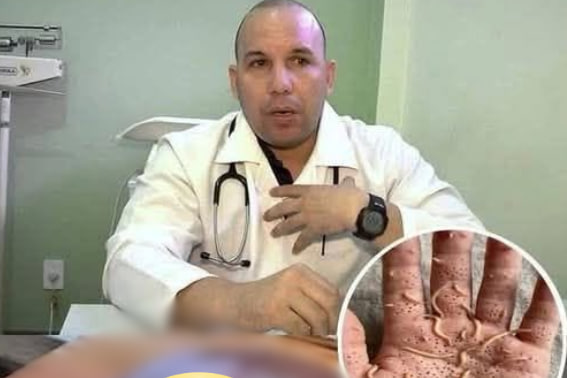 HT14. Doctors reveal that eating beef liver can cause…See more