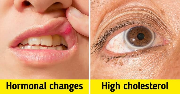 ST7. You should be aware of the warning signs your body is telling you.