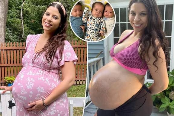 ST4. Triplet Mom Who Went Viral For Her Baby Bump Shares Postpartum Belly Pics