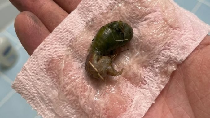 HT1. We found this in our bathroom. When I first saw it, I was really scαred.