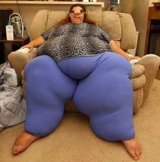HT6. This woman lost 518 pounds at 47 and here’s what she looks like after…