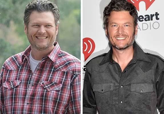 ST3. Blake Shelton’s Health Journey: Separating Fact From Inspiration