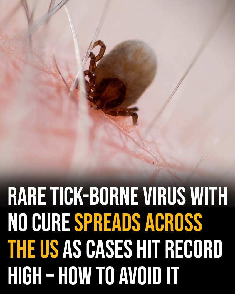 HT1. Rare tick-borne virus with no cure spreads across the US as cases hit record high – how to avoid it