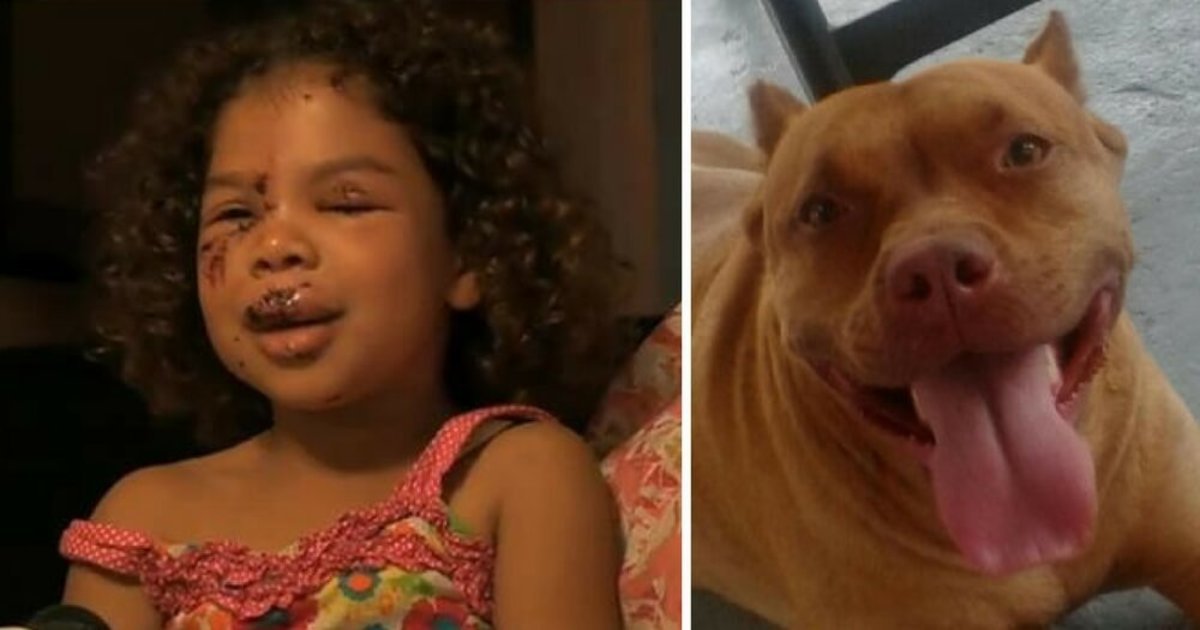 HT2. 5-year-old gets bitten by neighbor’s labrador