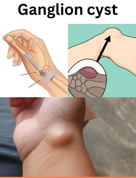 HT3. Healing Power And Important Safety Tips Of Castor Leaves