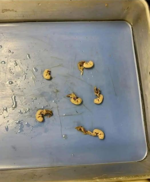 HT3. Hidden Seeds Food Warning