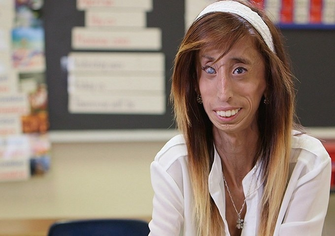 ST3. Lizzie was mocked for her looks her entire life, but she is fighting back with optimism