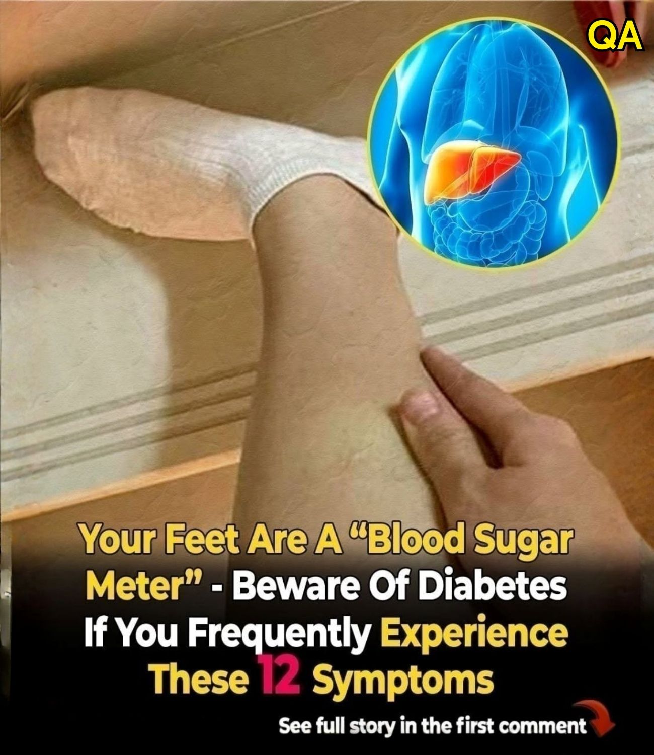 HT3. Your Feet Are a “Blood Sugar Meter” – Beware of Diabetes If You Frequently Experience These 12 Symptoms