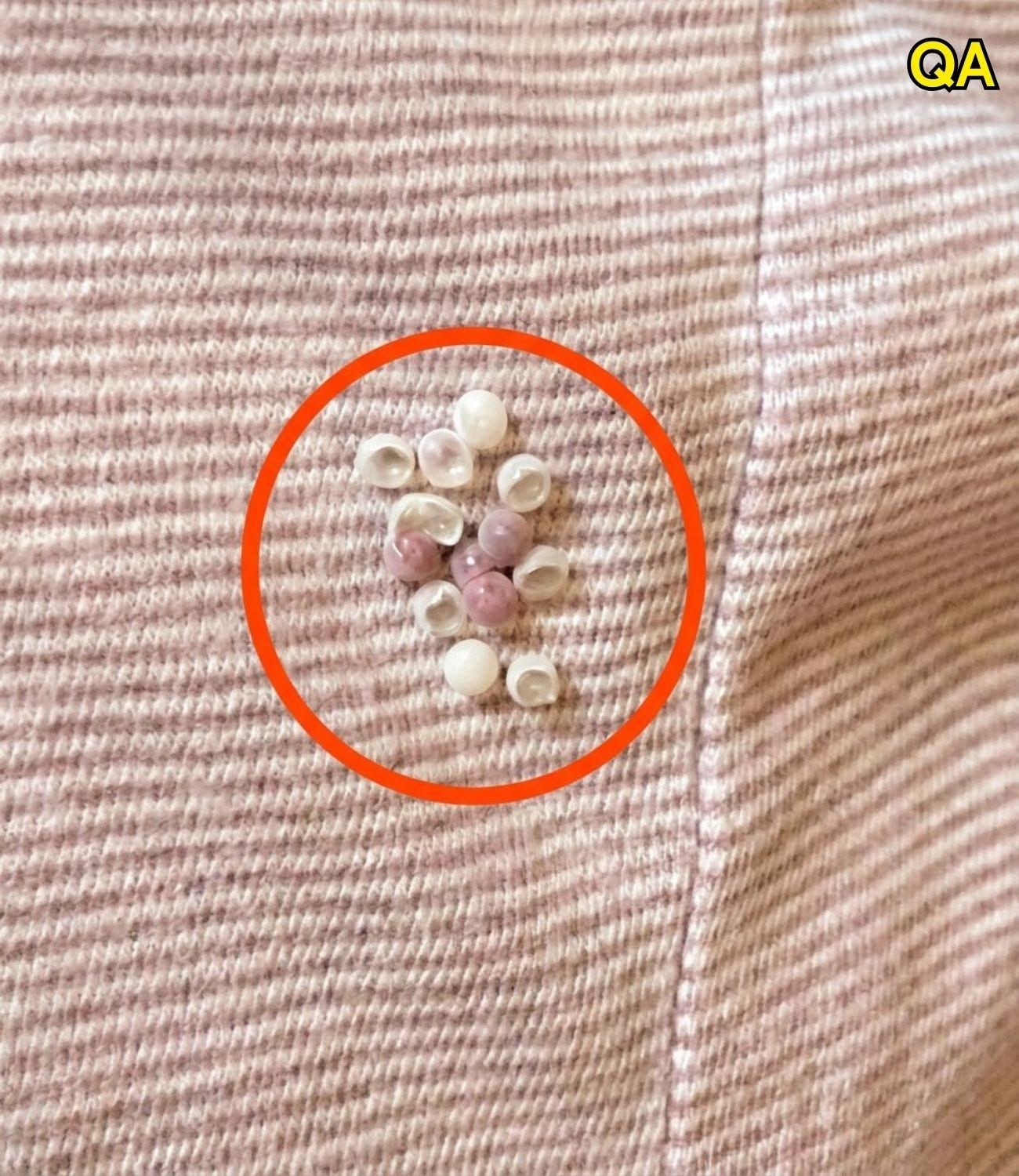 HT1. I found these tiny balls in my bed and nearly had a heart att.ack: here’s what they were