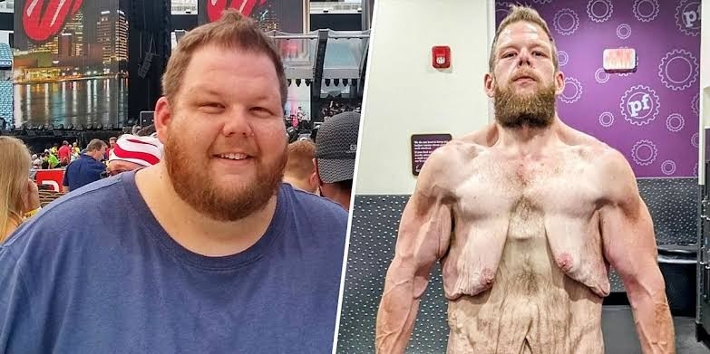 ST4. The Scale Refused to Measure Him: How One Man Secretly Shed 360 Pounds and Shocked the World