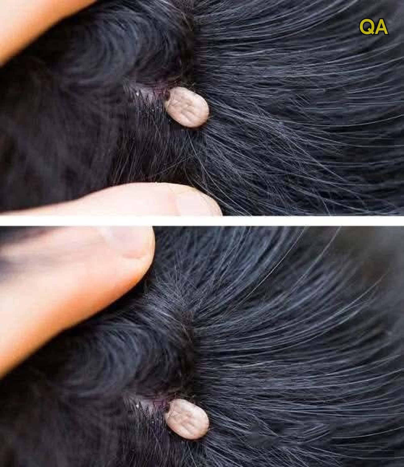 HT1. A Surprising Discovery in a Child’s Hair Raises Concern, Curiosity, and Urgent Questions as Parents Try to Understand What a Strange Beige Lump Really Is