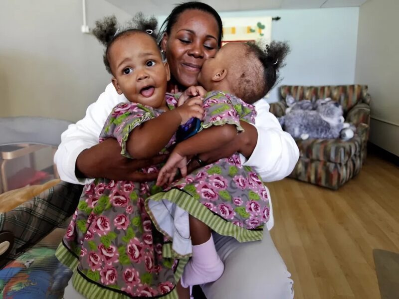 ST3. Born Joined Together, They Defied the Odds—See María and Teresa Today
