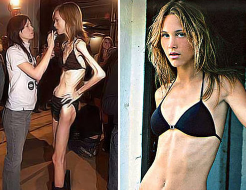ST4. Why Ultra-Thin Models Continue to Spark Debate in Fashion Despite Health Initiatives
