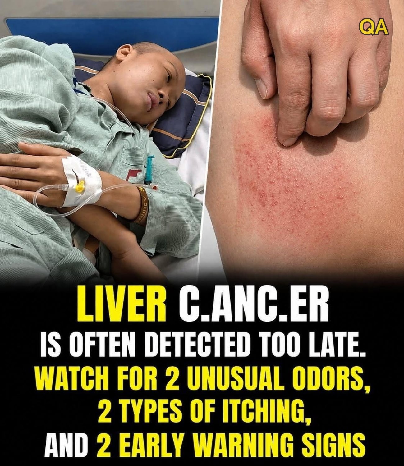HT4. Watch for 2 Unusual Odors, 2 Types of Itching, and 2 Early Warning Signs.