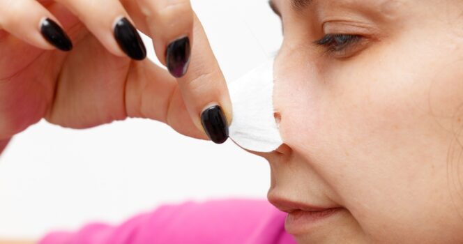 HT3. Woman’s dog alerted her to deadly disease which lead to her prosthetic nose