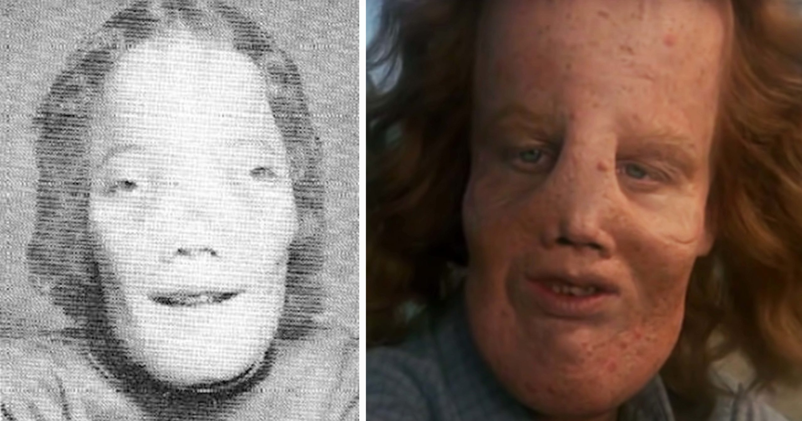 HT4. Rocky Dennis: The true story of the boy who inspired ‘Mask’
