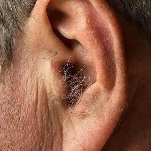 HT1. Did You Know That If Hair Grows On Your Ears It Is Not A Sign Of Illness Or Mystery But A Natural Result Of Aging Hormones Genetics And Time Working Quietly Inside The Human Body Over Many Decades