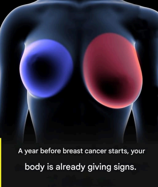 HT1. Breast Cancer: 4 Warning Signs Women Must Recognize Early –