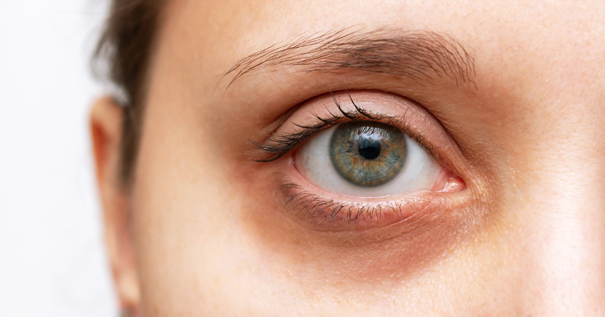 HT1. Woman sees through tooth 11 years after losing sight