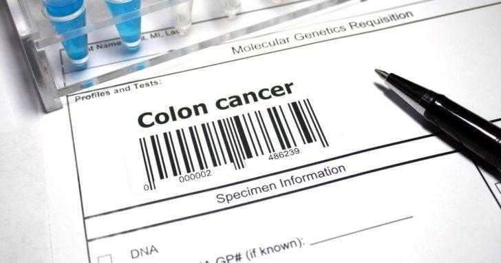 HT1. Woman reveals 5 colon cancer symptoms that shouldn’t be ignored –
