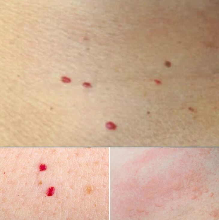 HT1. Red dots on your skin: Causes and what they could mean –