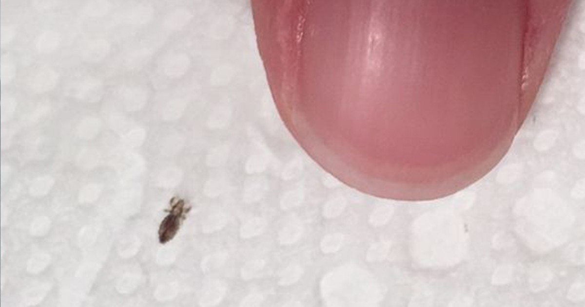 HT1. Head lice: How to get rid of them and stop them coming back