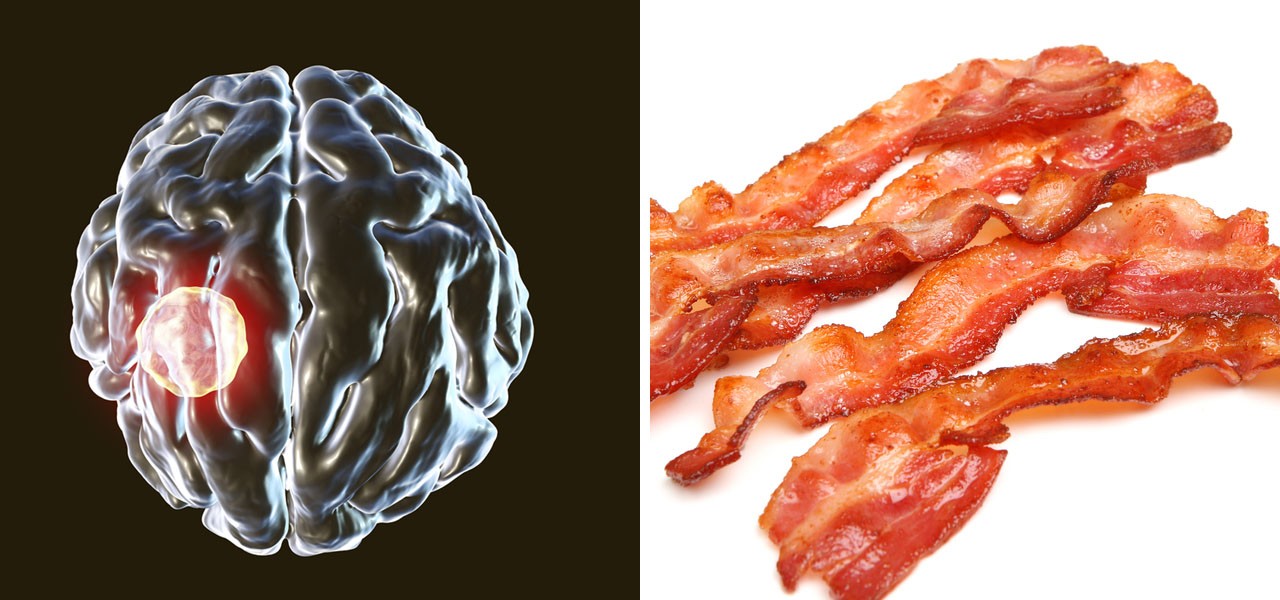 HT1. Man develops ‘pork worms’ after years of one specific cooking habit