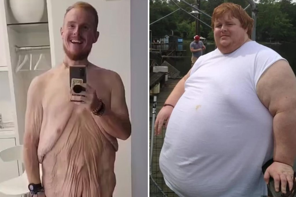 ST2. “Family By the Ton” Star Casey King Loses 600 Pounds After Bariatric Surgery and Four-Year Health Overhaul