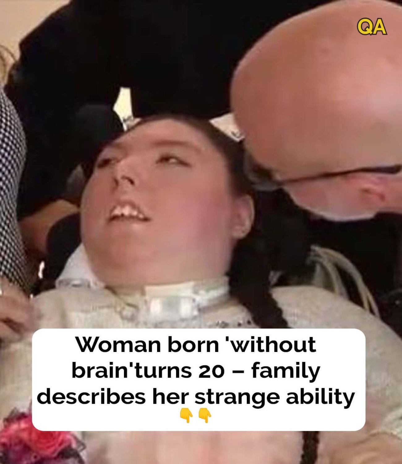 HT2. Woman born without brain turns 20, family calls her ‘miracle’