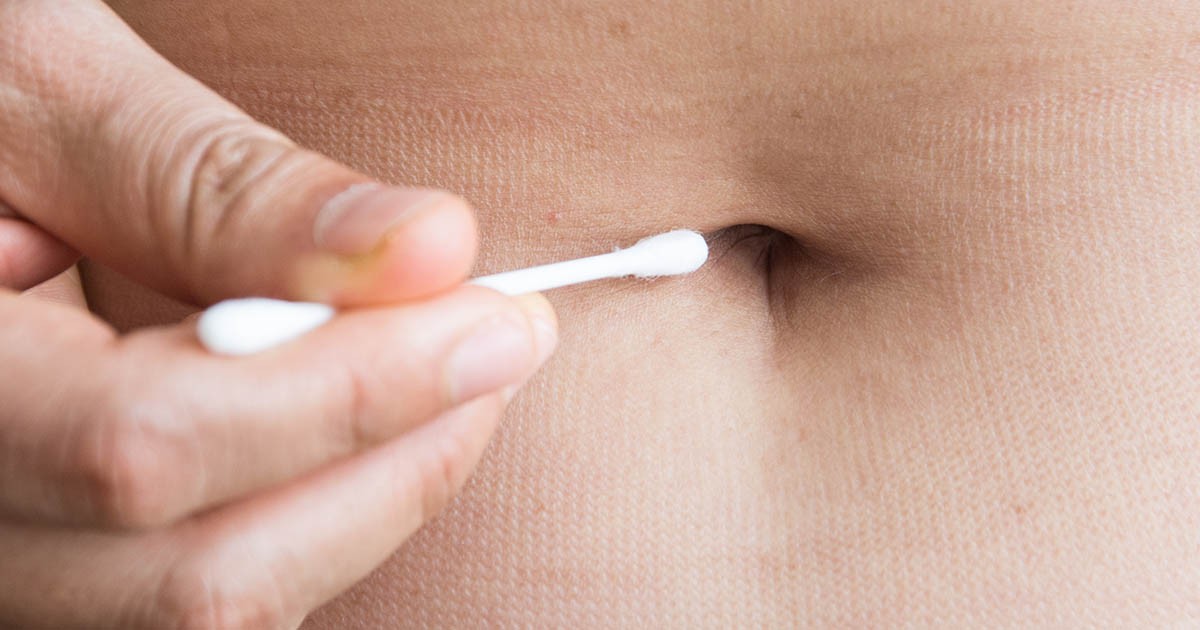 HT3. Doctors warn a smelly belly button may signal a bigger problem