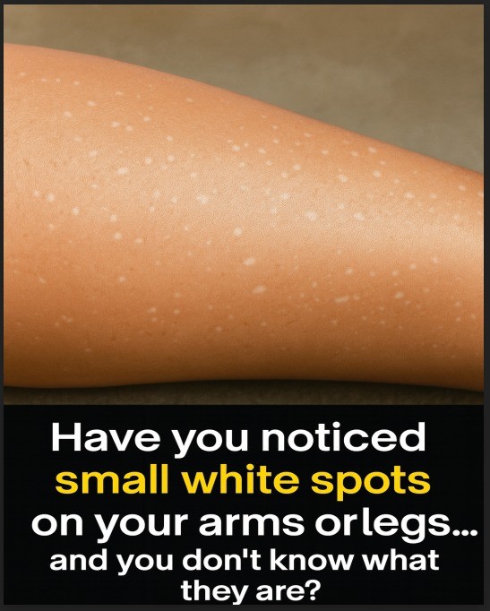 HT1. What Vitamin Deficiencies May Lead to White Spots on the Skin
