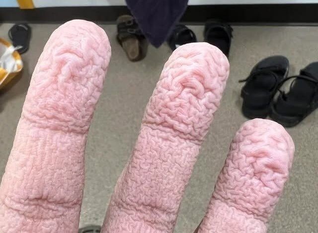 HT4. Wrinkled Fingers After Water Exposure What Your Skin May Be Telling You – Story Of The Day!