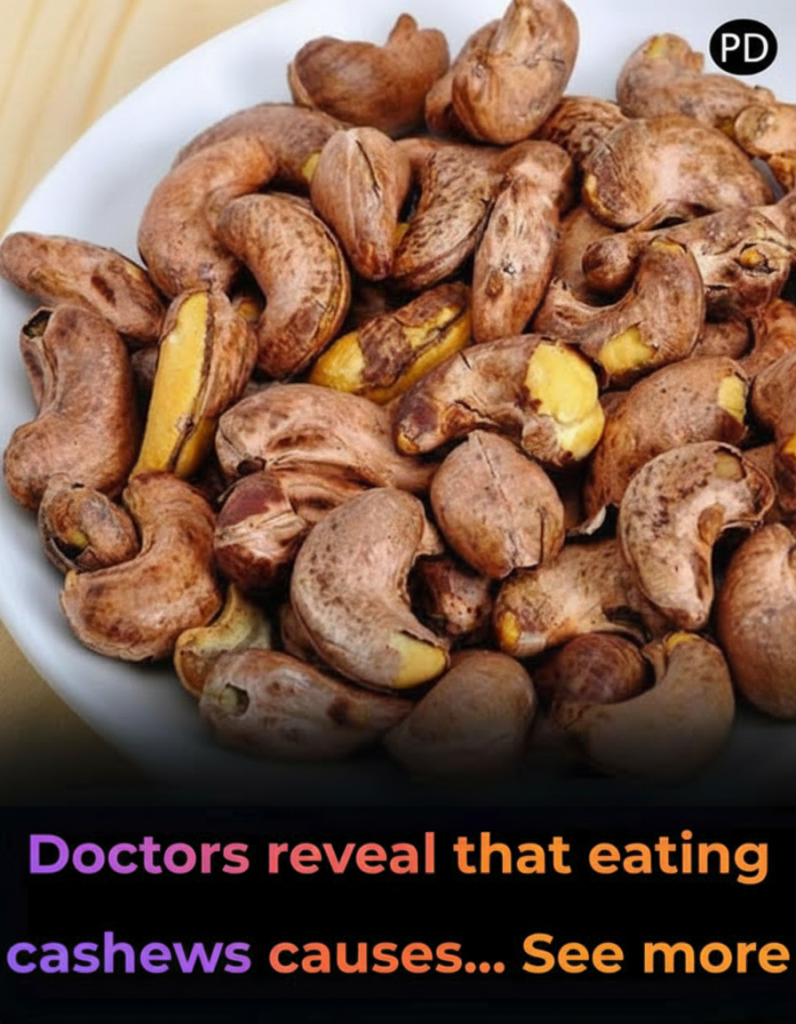 HT4. Doctors reveal that eating cashews causes