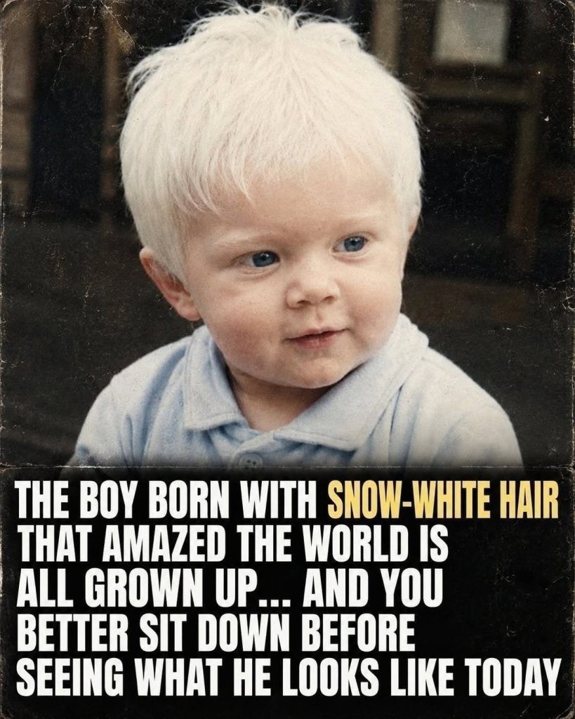 HT4. The Boy With Snow-White Hair Who Captivated the World – Where Is He Now?