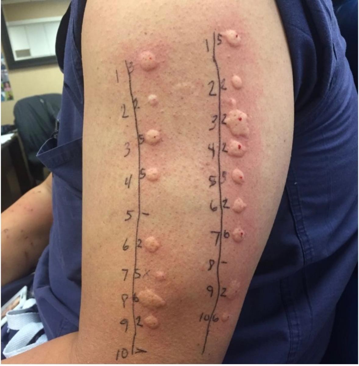HT4. These are the consequences of sleeping with the… See more