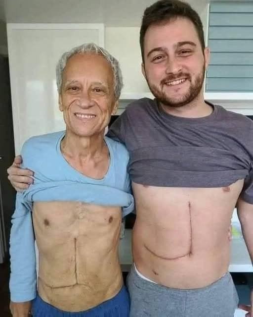 HT3. Son who donated part of his liver to his father unfortunately ends up fa… See more