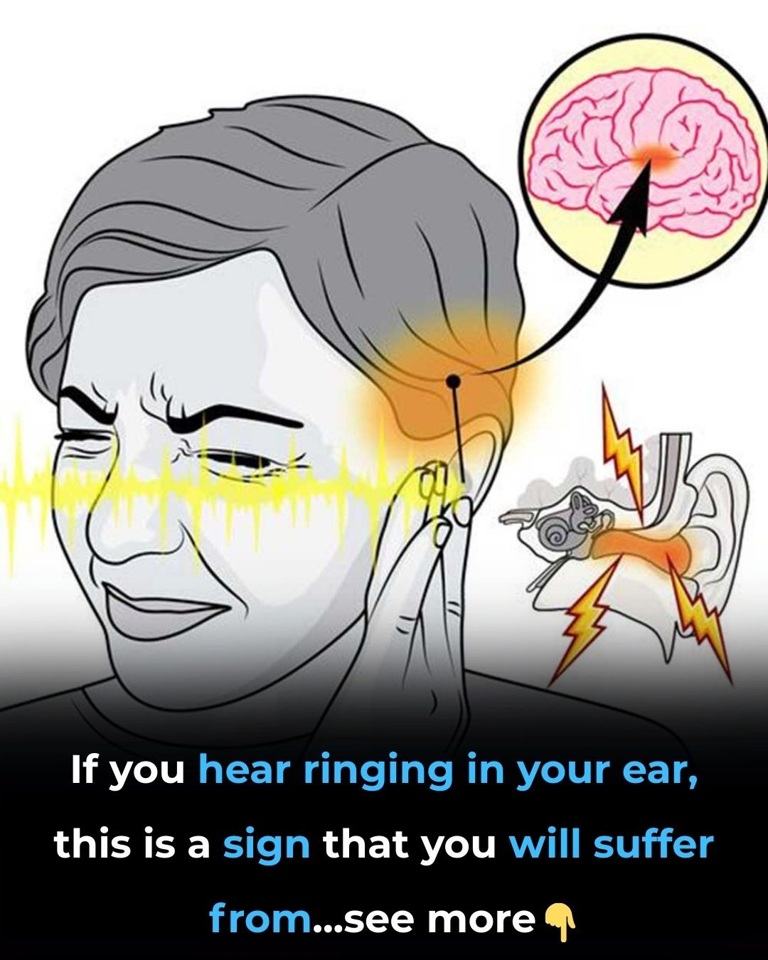 HT3. Ringing in Your Ear? What Tinnitus Really Means and When to See a Doctor